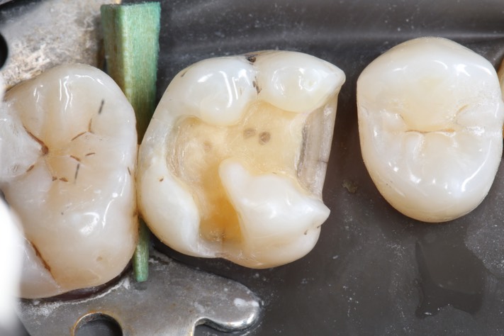 Brandon Yokota #3 prep