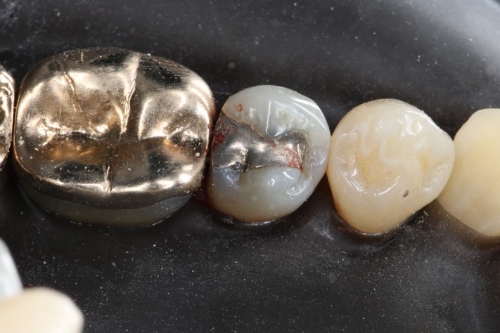 Russ Tabata #29 pre-op