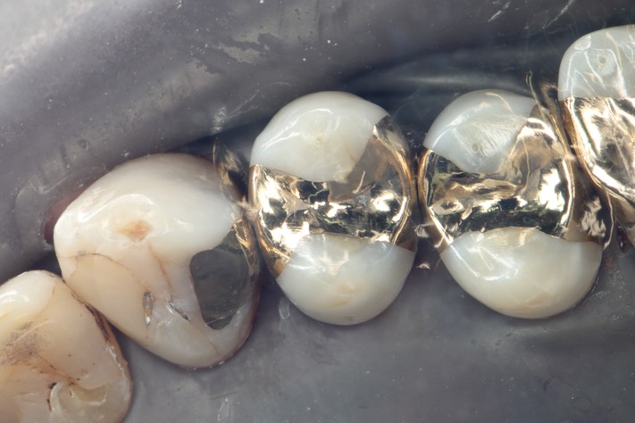 Larry Fujioka #4,5,6 finish