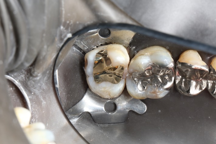 Kyle Chock #15 finish