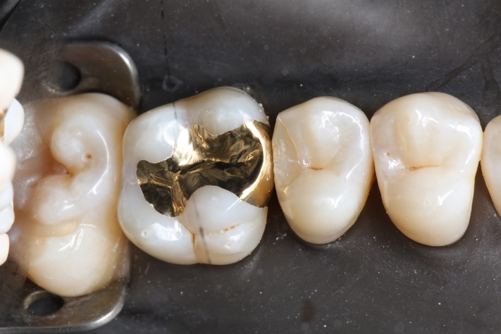 Scott Kanamori #14 finish