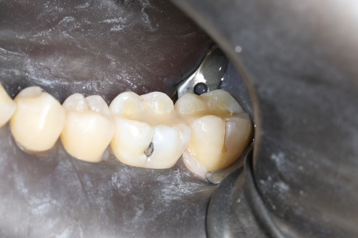 Gary Umeda #18-19 pre-op 2