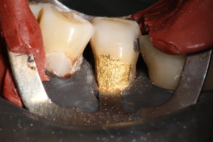 Ted Kanamori #20 fill