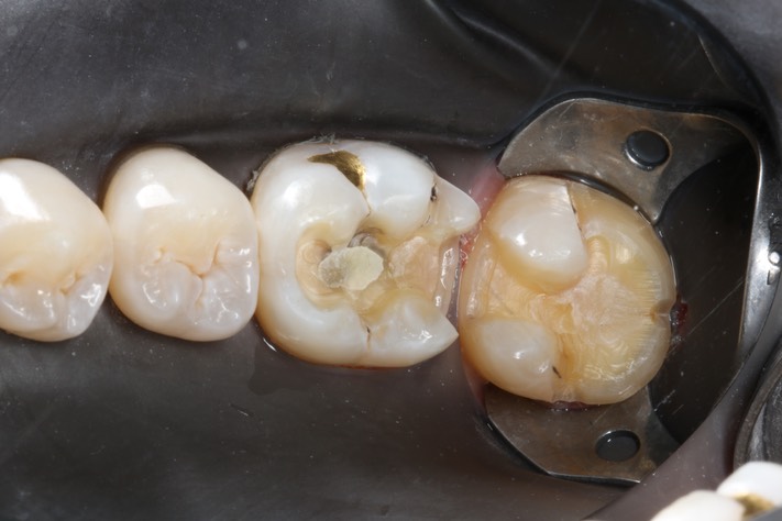 Gary Umeda #18-19 prep