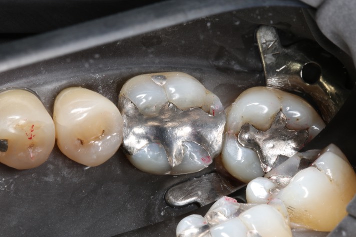 Alan Chinn #19 pre-op