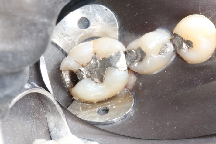 Wayne Chin #30 pre-op