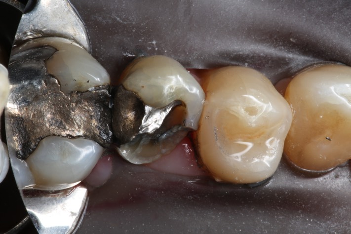 Chris Woo #13 pre-op