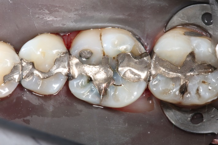 Larry Fujioka #19 pre-op