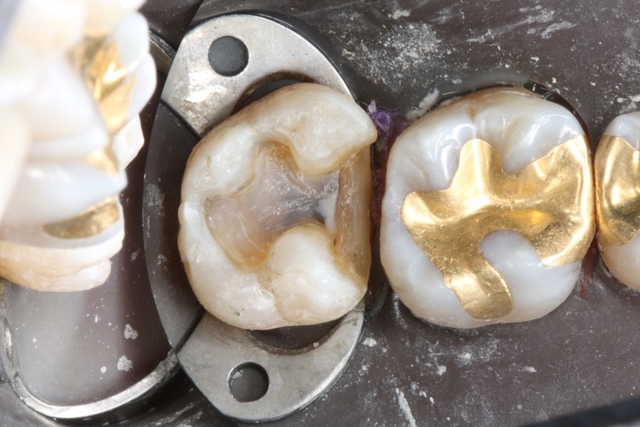 Alan Tamashiro #15 prep