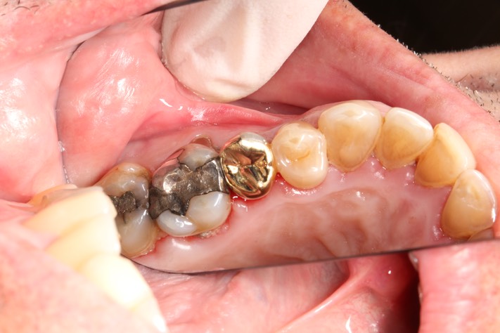 Chris Woo #13 finish