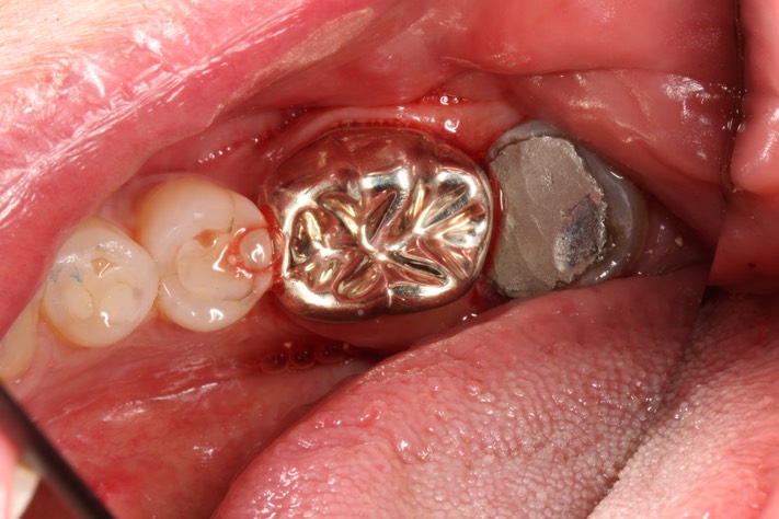 Matt Dodson #18 finish