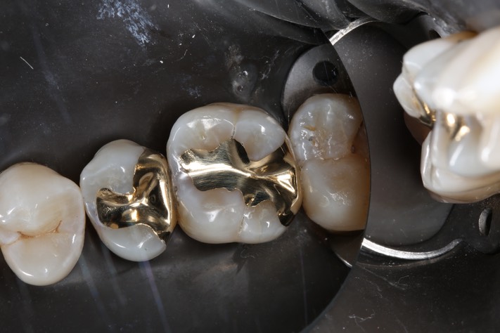 Kyle Chock #3 finish