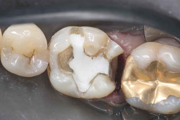 Frank Fukuda #19 prep