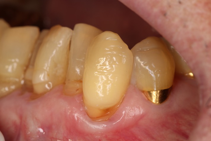 Ted Kanamori #24 pre-op