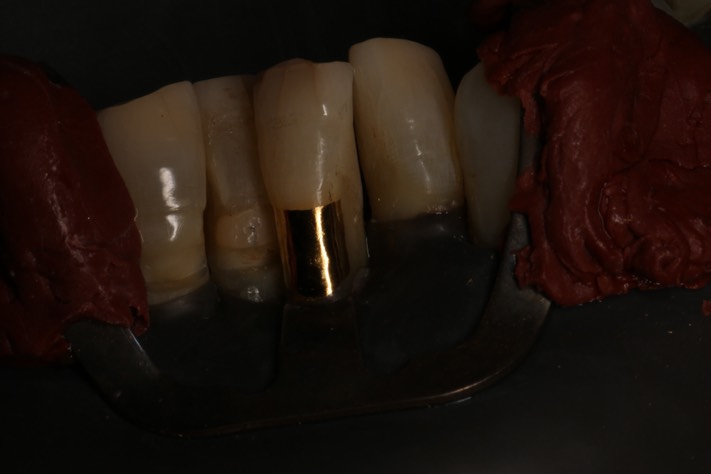 Ted Kanamori #24 finish