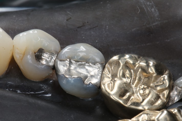 Wayne Chin #20 pre-op