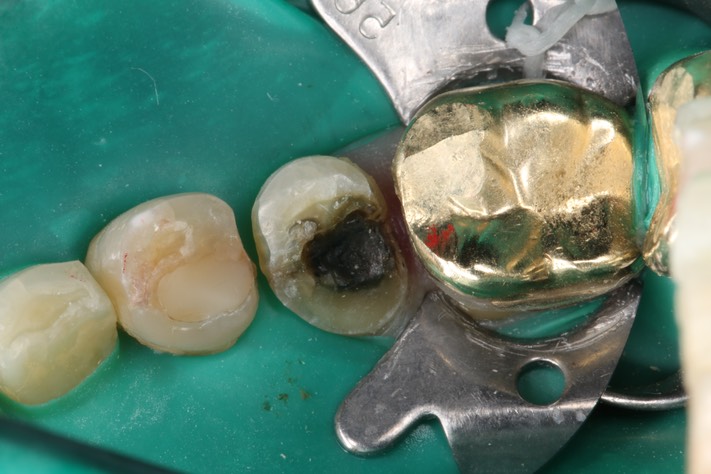 Bryan Sato #20 pre-op