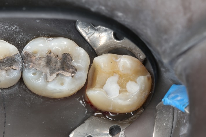 Frank Fukuda #18 prep