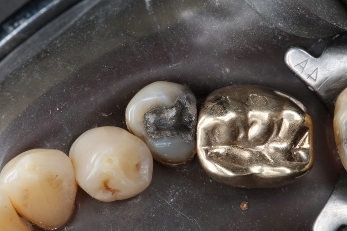 Larry Fujioka #20 pre-op