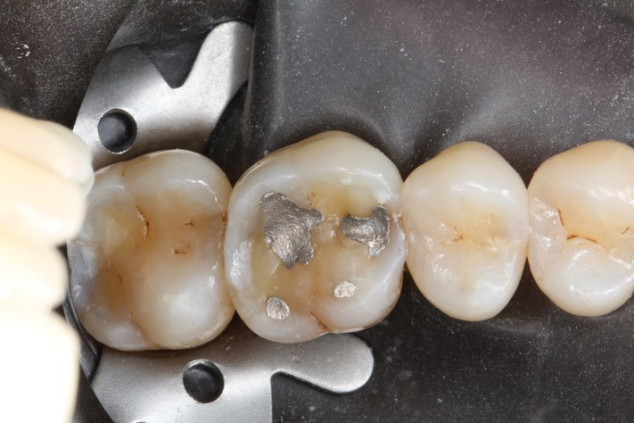 Russ Tabata #14 pre-op