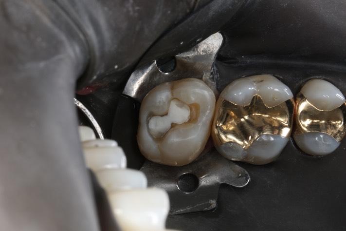 Ted Kanamori #15 prep