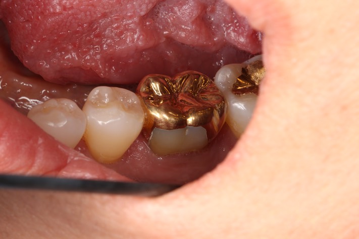 Chris Woo #30 finish