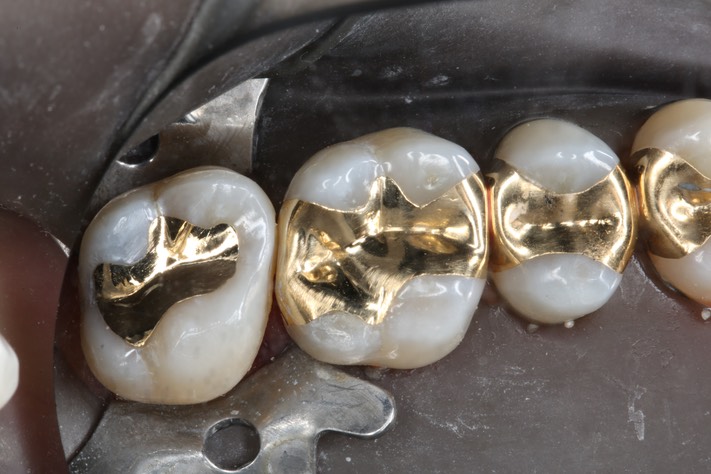 Ted Kanamori #15 finish