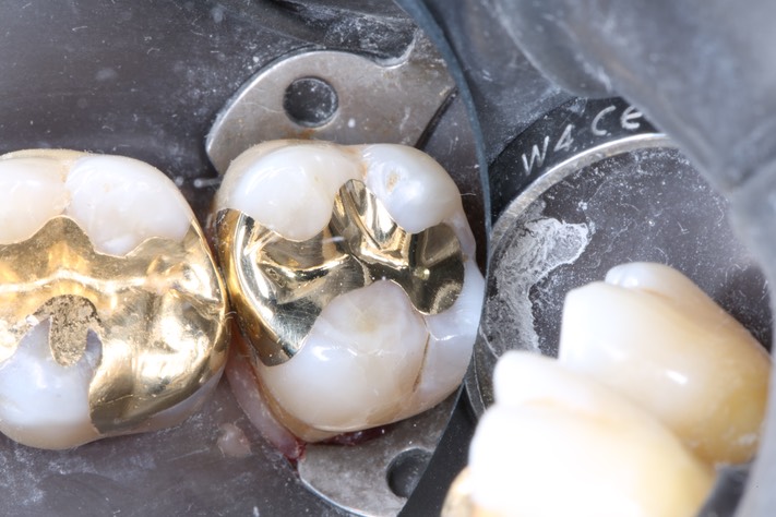 Gary Umeda #2 finish