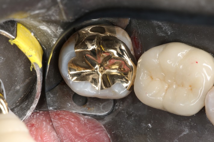 Scott Kanamori #31 finish 