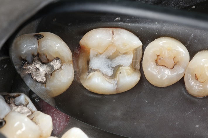 Alan Tamashiro #30 prep