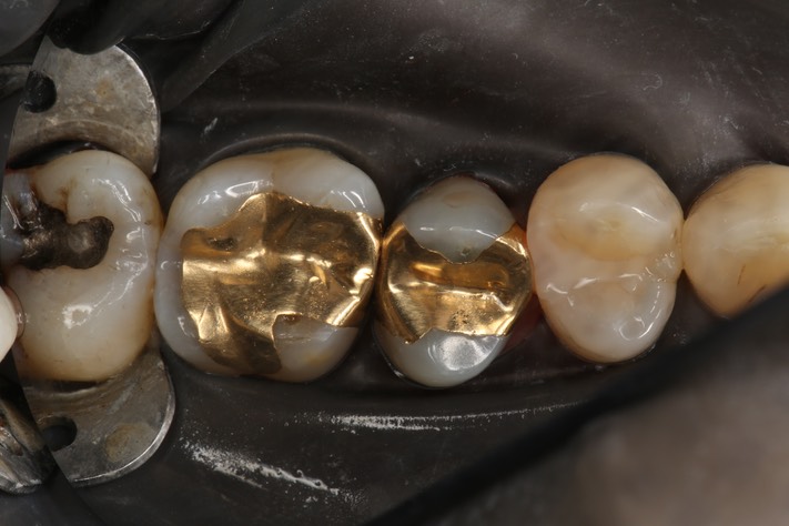 Wayne Chin #14 pre-op