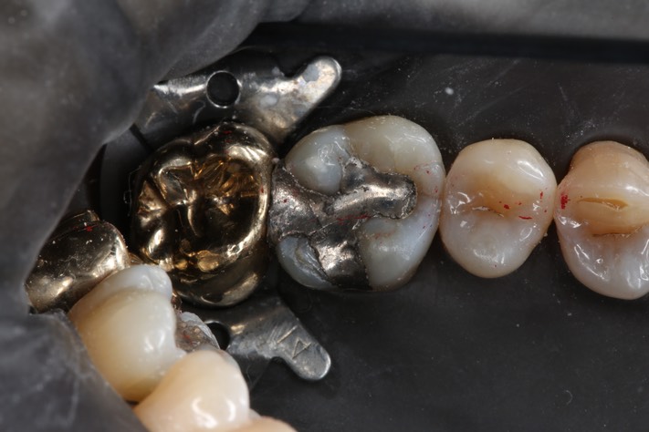 Alan Chinn #14 pre-op