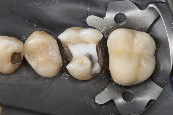 Frank Fukuda #3 prep