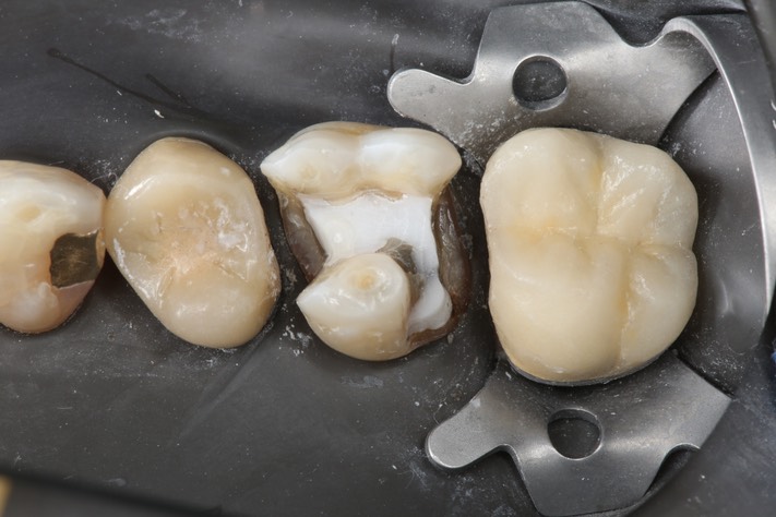 Frank Fukuda #3 prep