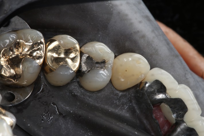 Scott Kanamori #12 pre-op