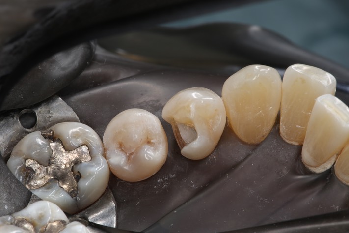 Larry Fujioka #28 prep