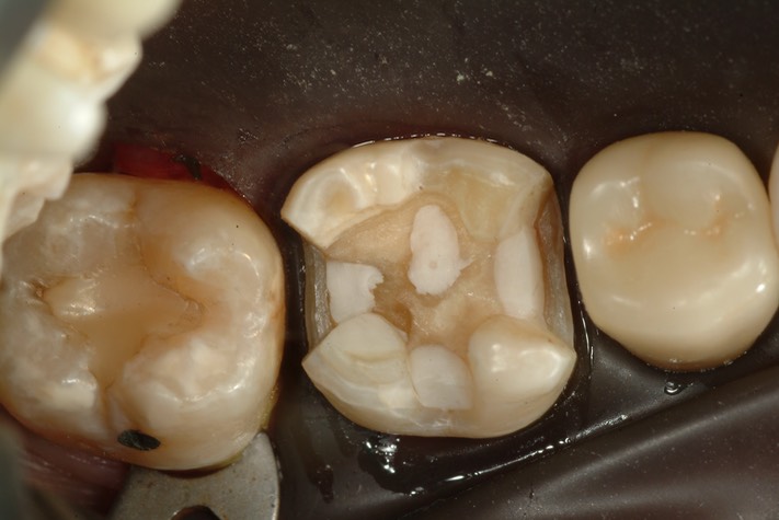 Larry Fujioka #30 prep