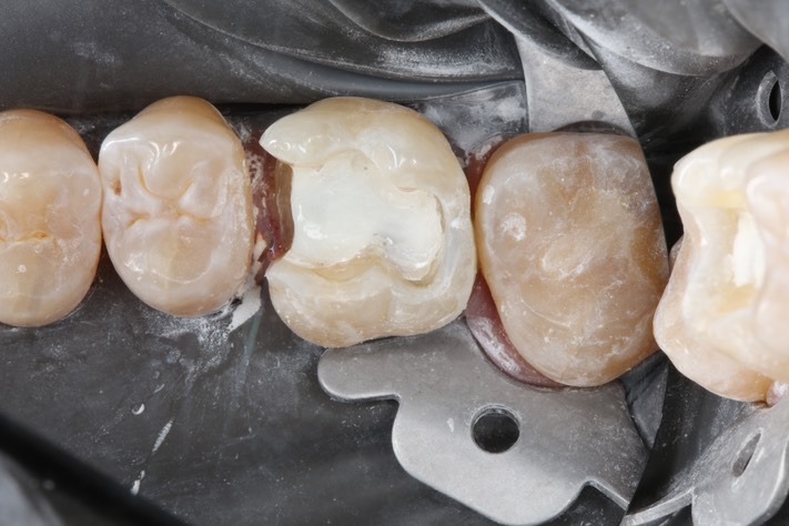 22Matt Dodson #3 prep