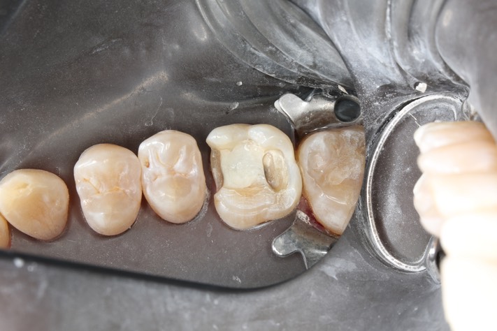 23Matt Dodson #3 reprep