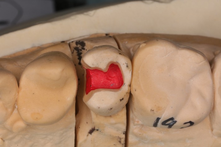 Alan Chinn #13 model