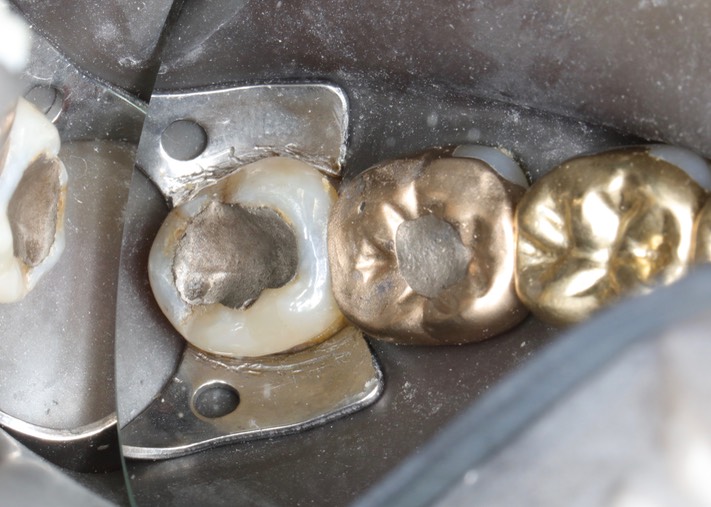 Alan Chinn #32 pre-op