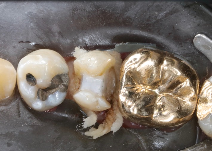 Frank Fukuda #20 prep