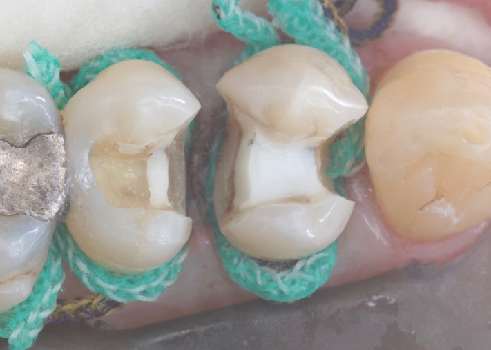 Larry Fujioka #12-13 prep 2