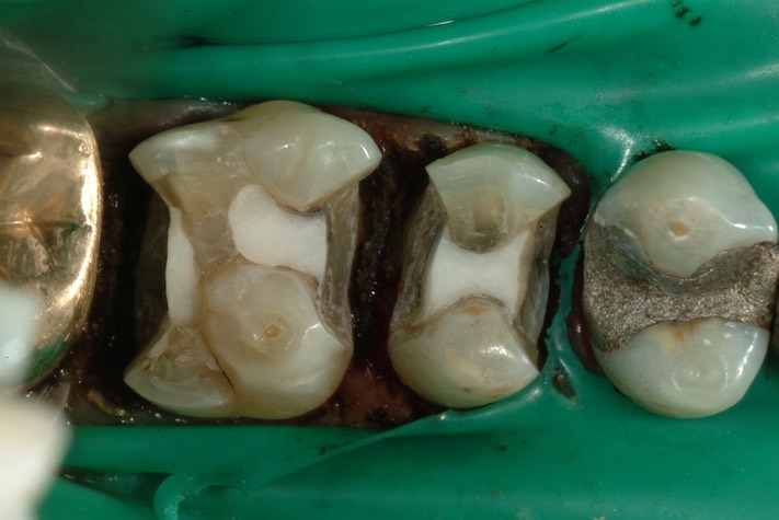 27Larry Fujioka #12 pre-op