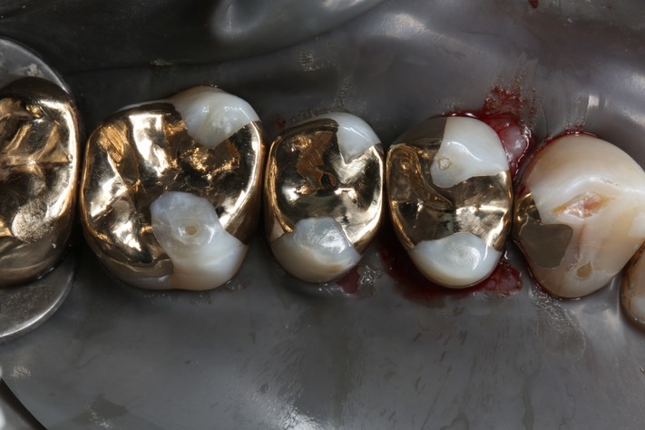 32Larry Fujioka #11 - 12 finish