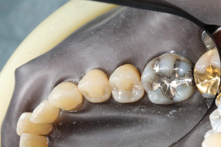 35Frank Fukuda #19 pre-op