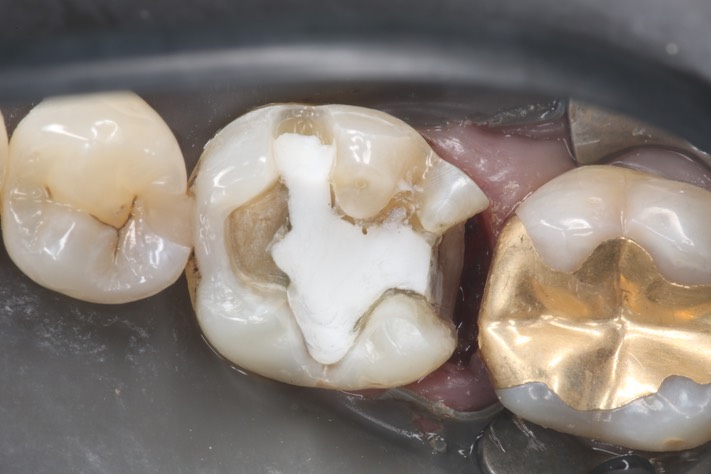 39Frank Fukuda #19 prep