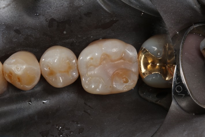 41Scott Kanamori #19 pre-op