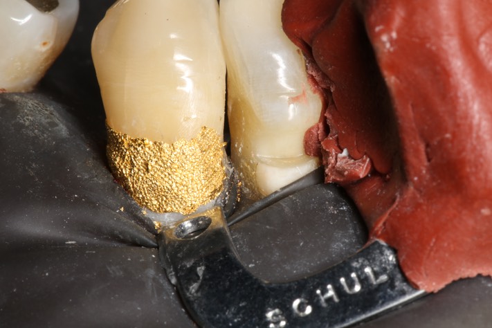 49Ted Kanamori #27 foil condensed