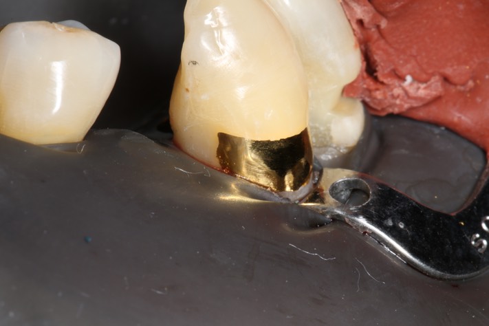 51Ted Kanamori #27 finish